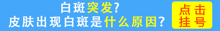 南京华厦白癜风